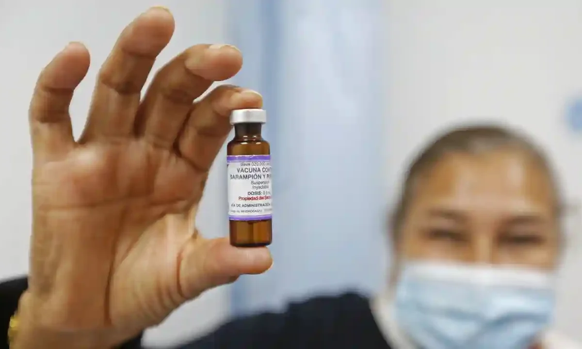 Secretaría de Salud, David Kershenobich sarampión
