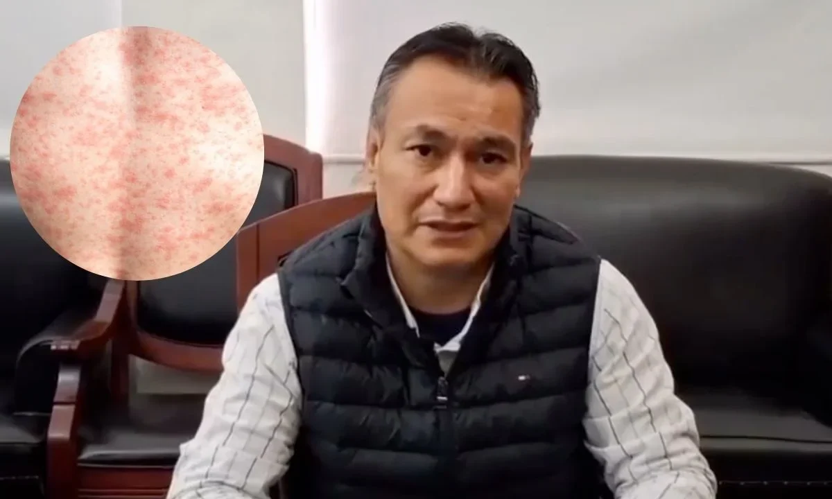 La Secretaría de Salud de Durango confirmó la primera muerte por sarampión en 2026, se trata de un niño de ocho años.